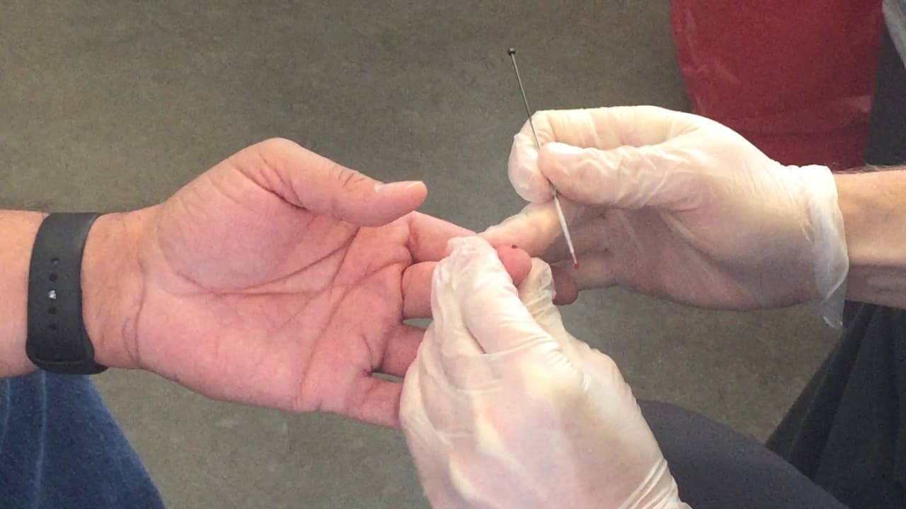 Todo el proceso inicia con una toma de sangre que en 7 minutos entrega la información del estado de la persona.