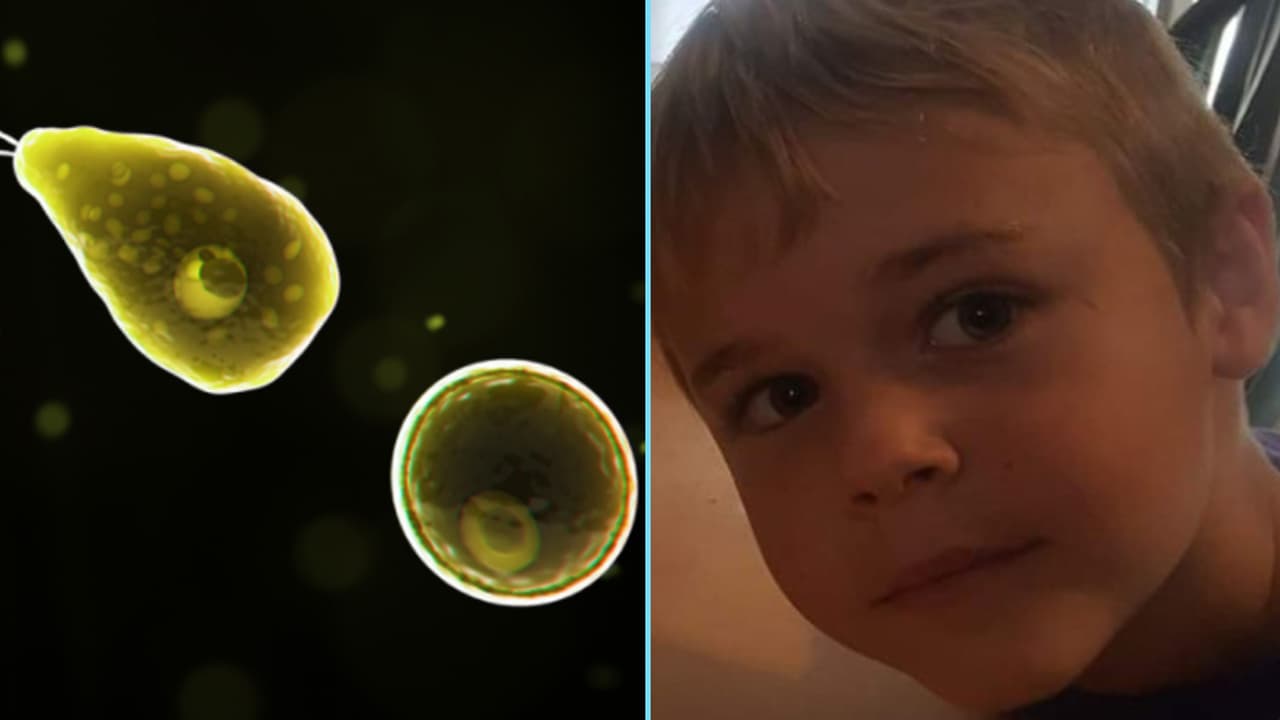 Niño muere de ameba 'come cerebros' después de nadar en un lago del norte de California