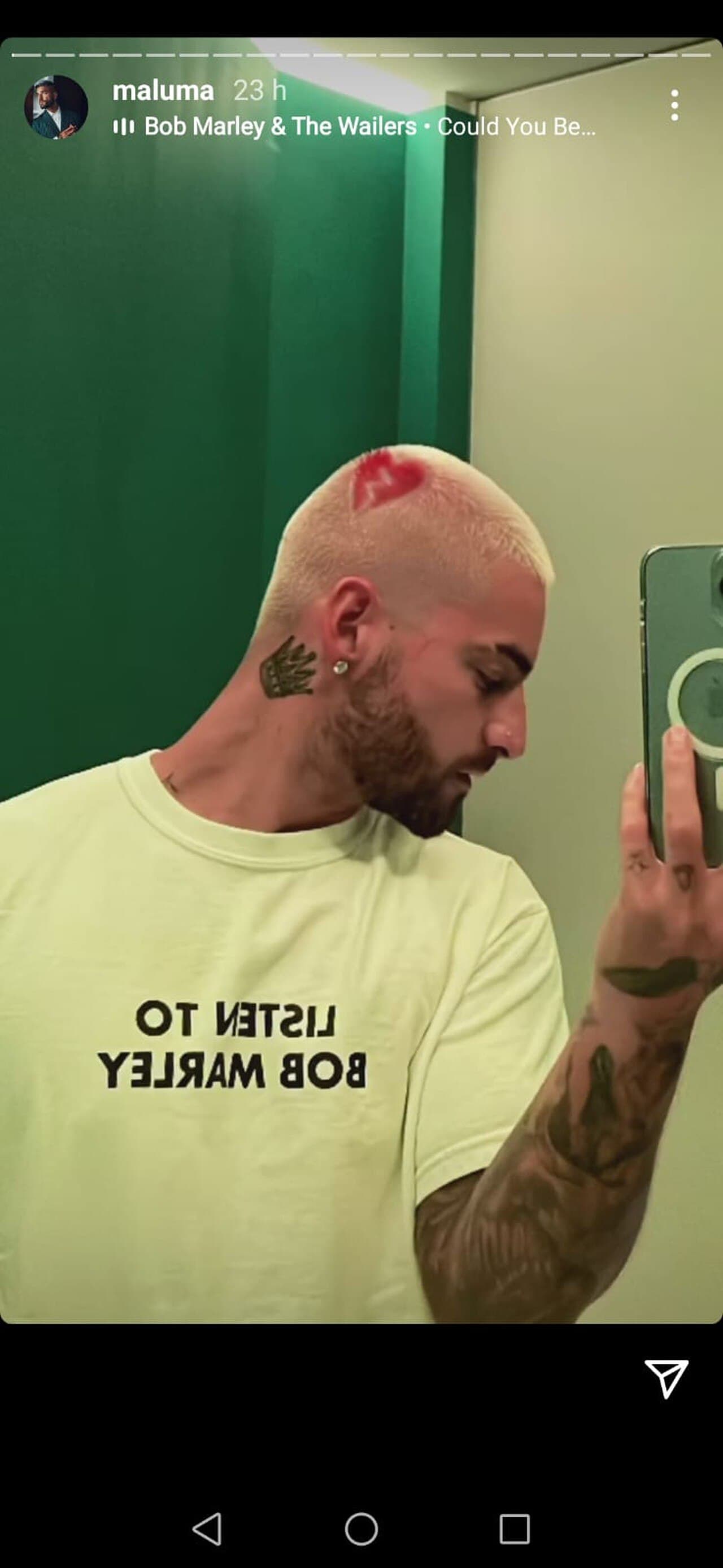 Maluma es otro artista que también suele teñirse el cabello de colores. Además, en diciembre de 2021 se colocó la figura de un corazón roto en la parte de atrás.