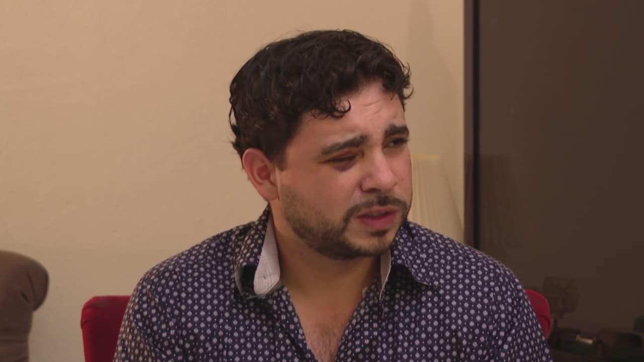 Joven sobrevive de milagro a un impacto de bala perdida en el ojo durante una fiesta