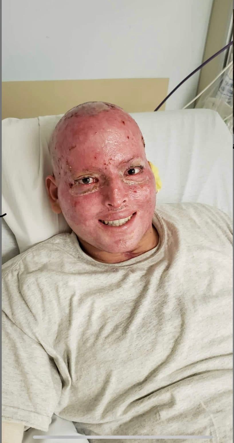 En ella, el puertorriqueño luce sonriente y con evidentes señales de las quemaduras que había sufrido su rosto. “La subí para que vieran lo bien que estaba y para decirle a otros que, si yo puedo ser feliz, ellos también”, apunto. 
<br>