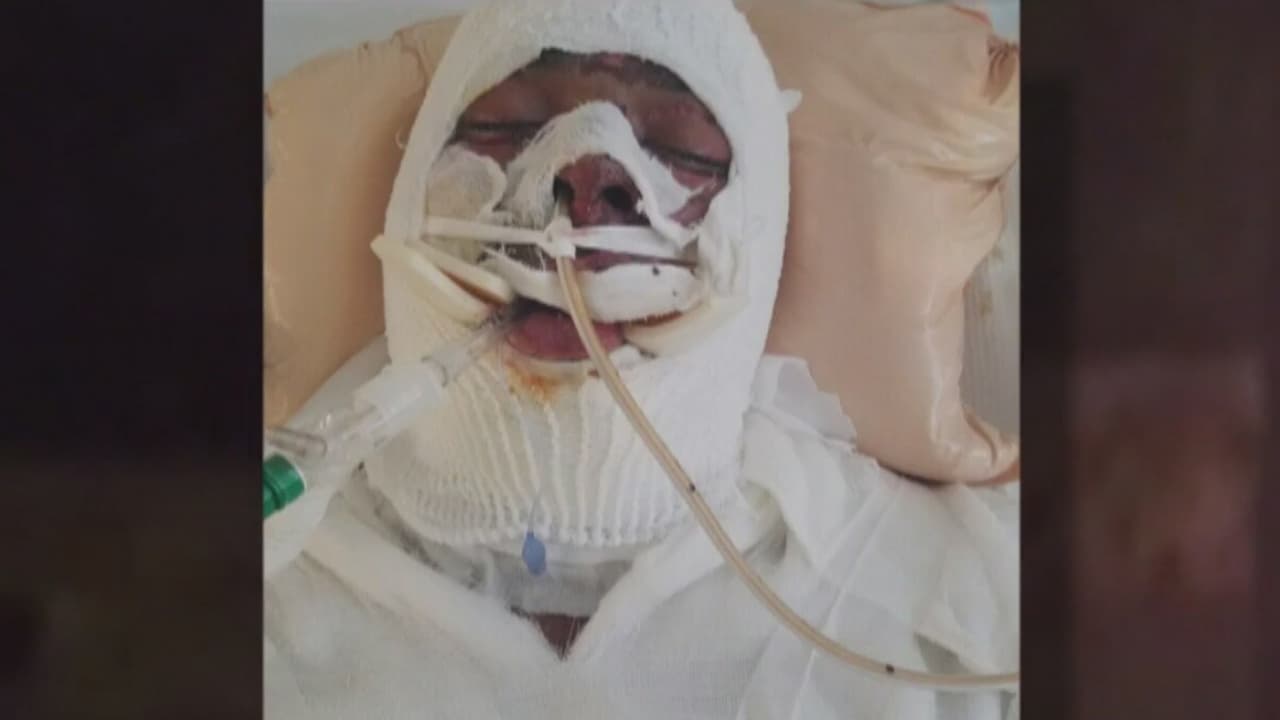 Se levanta con pesadillas y llora mucho: hablan los padres del hispano pateado por la policía mientras ardía en llamas