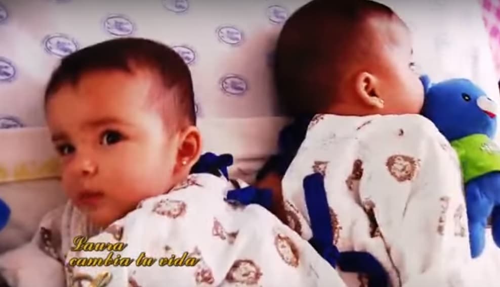 Cuando la peruana conducía 'Laura', en Televisa, conoció a estas pequeñas y decidió ayudarlas. De hecho, las presentó en una trasnmisión en vivo cuando recién las separaron: "Estoy en estado de shock porque las veo separadas y es la primera vez que las veo tan bien”.