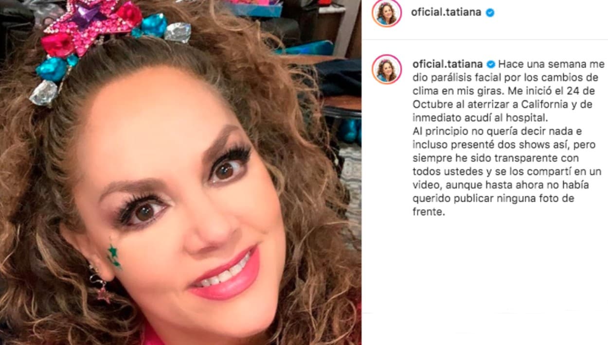 "Sé que muchos me han estado preguntando cómo sigo y les agradezco su preocupación y su interés. Gracias a sus buenas vibras, y claro a la terapia y a las vitaminas, 
<b><a href="https://www.univision.com/radio/el-bueno-la-mala-y-el-feo/el-dr-juan-rivera-explica-por-que-le-dio-paralisis-facial-a-tatiana-y-como-se-puede-prevenir-video" target="_blank">me estoy recuperando muy rápido</a></b> y quiero compartirlo con ustedes", añadió, presentando esta segunda foto de su estado actual.