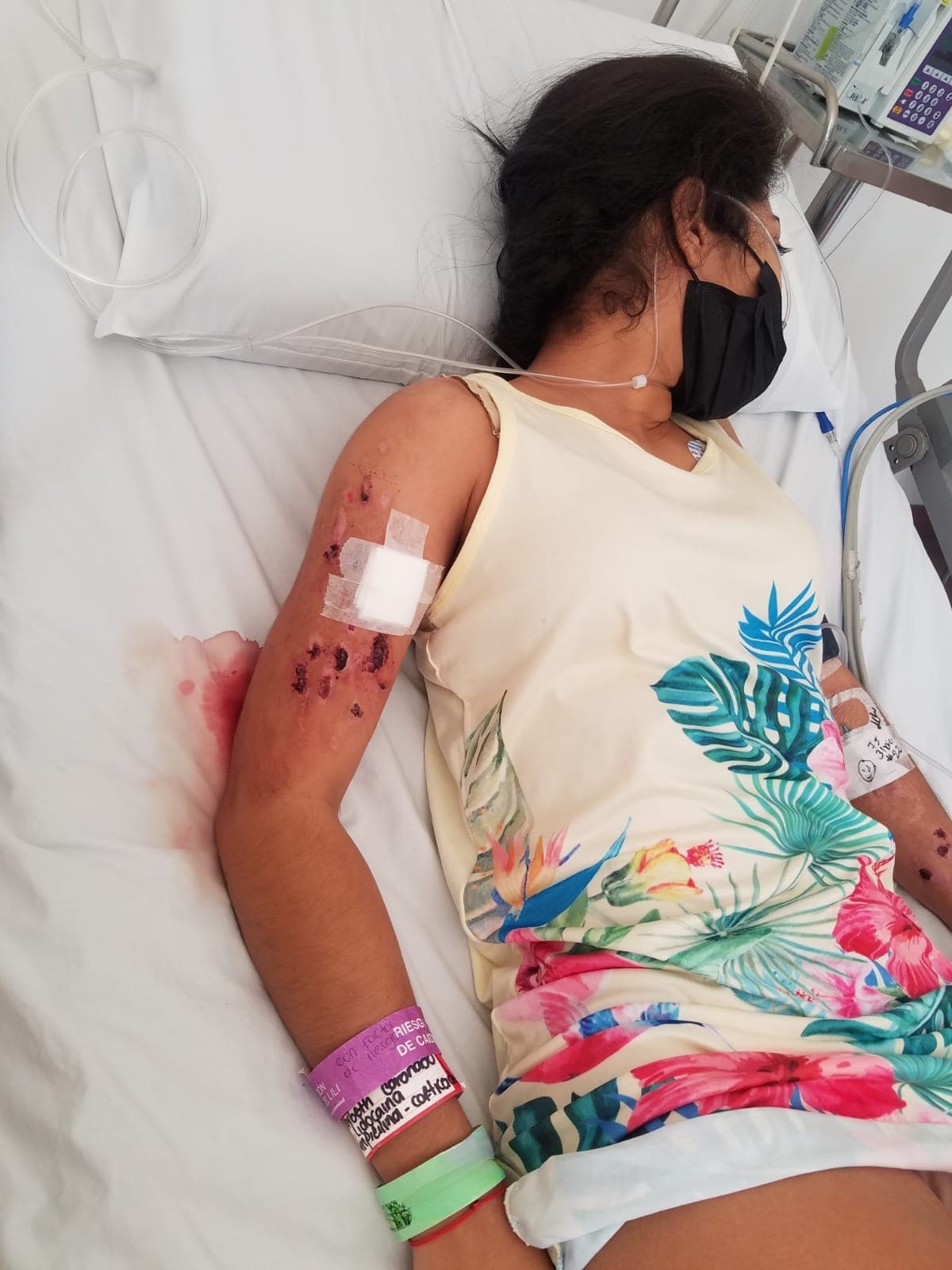 Debido al dietilen glicol -utilizado para radiadores de automóviles- que se le aplicó a la joven, Coronado sufrió terribles llagas en su boca y, sin poder encontrar una cura precisa, el daño se fue extendiendo por todo su cuerpo. 
<b>“Cada vez que me lo ponía le decía (a la doctora) que me quemaba y que me dolía, pero ella insistía en que me pusieran más porque me iba a ayudar”</b>, rememora Coronado.
<br>