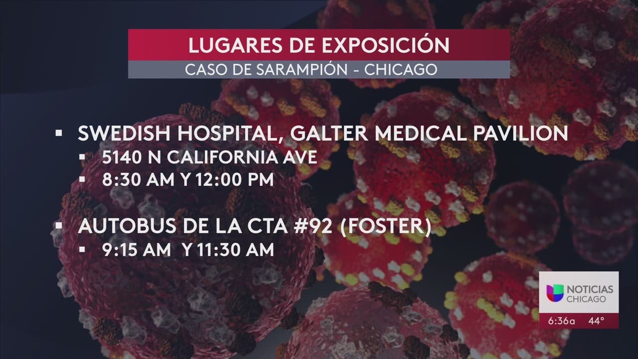 Confirman 2 casos de sarampión en Chicago: ¿Qué debe saber y cómo protegerse de ser infectado? Acá le decimos