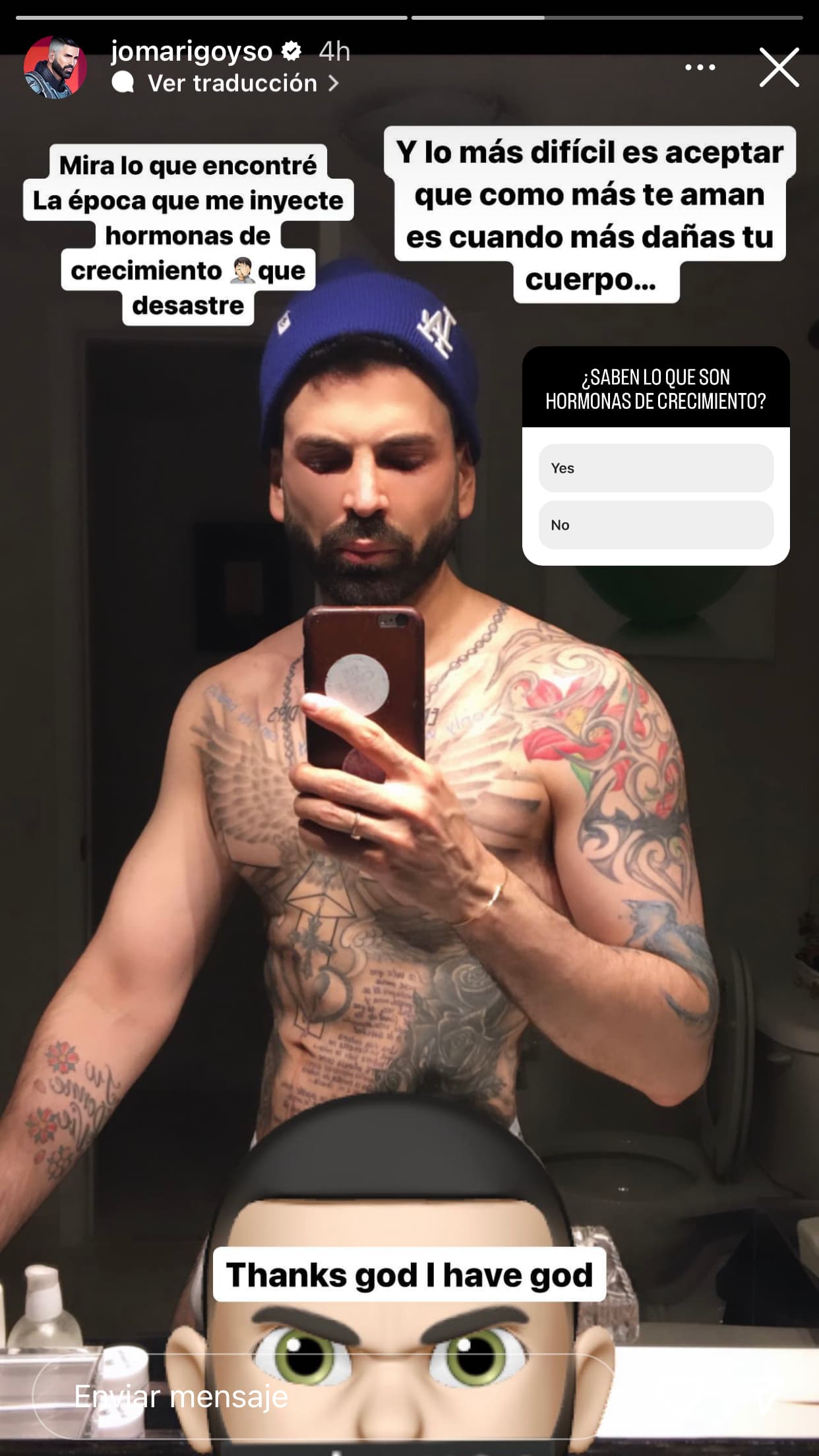 Jomari Goyso recuerda cómo lucía cuando se inyectaba hormonas