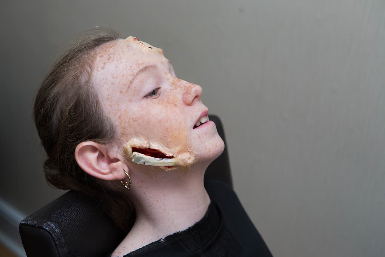 Cualquiera podría pensar que Keira tuvo un doloroso y horrible accidente.