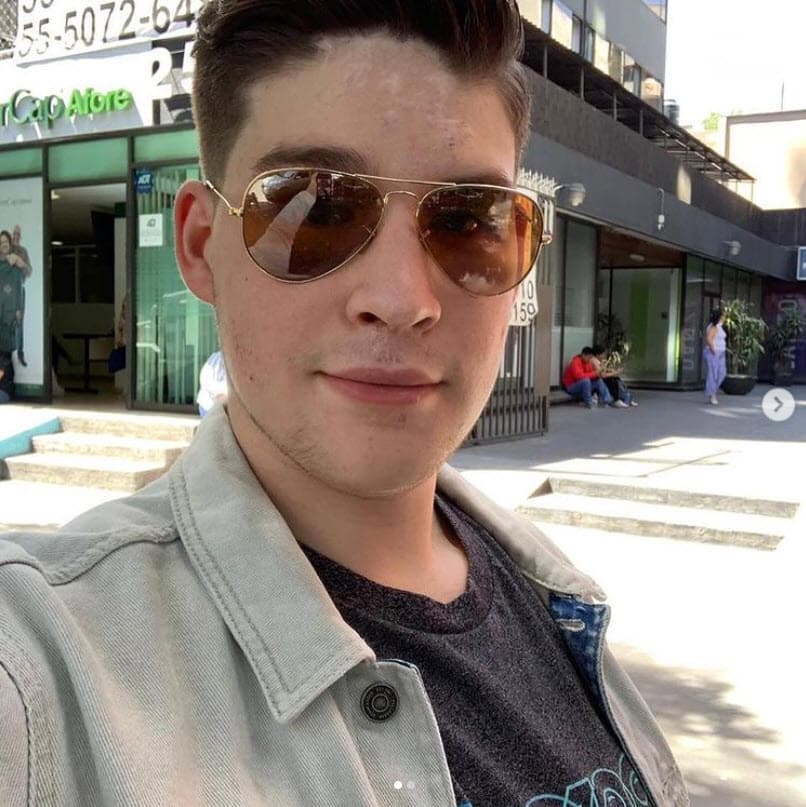 También compartió que 
<b>su nariz tuvo que ser reconstruida </b>por el fuerte golpe.
<br>