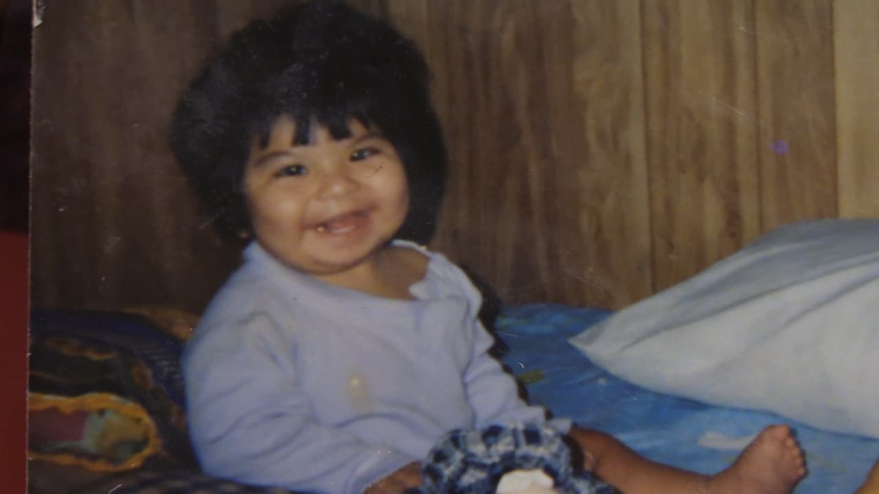 La hidrocefalia es una enfermedad que consiste en la acumulación de líquido dentro de las cavidades profundas del cerebro.
<br>