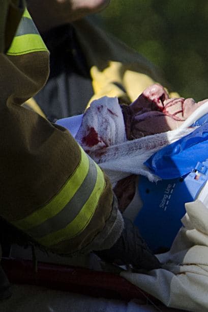 Luego de haberse roto la pelvis y un hombro.