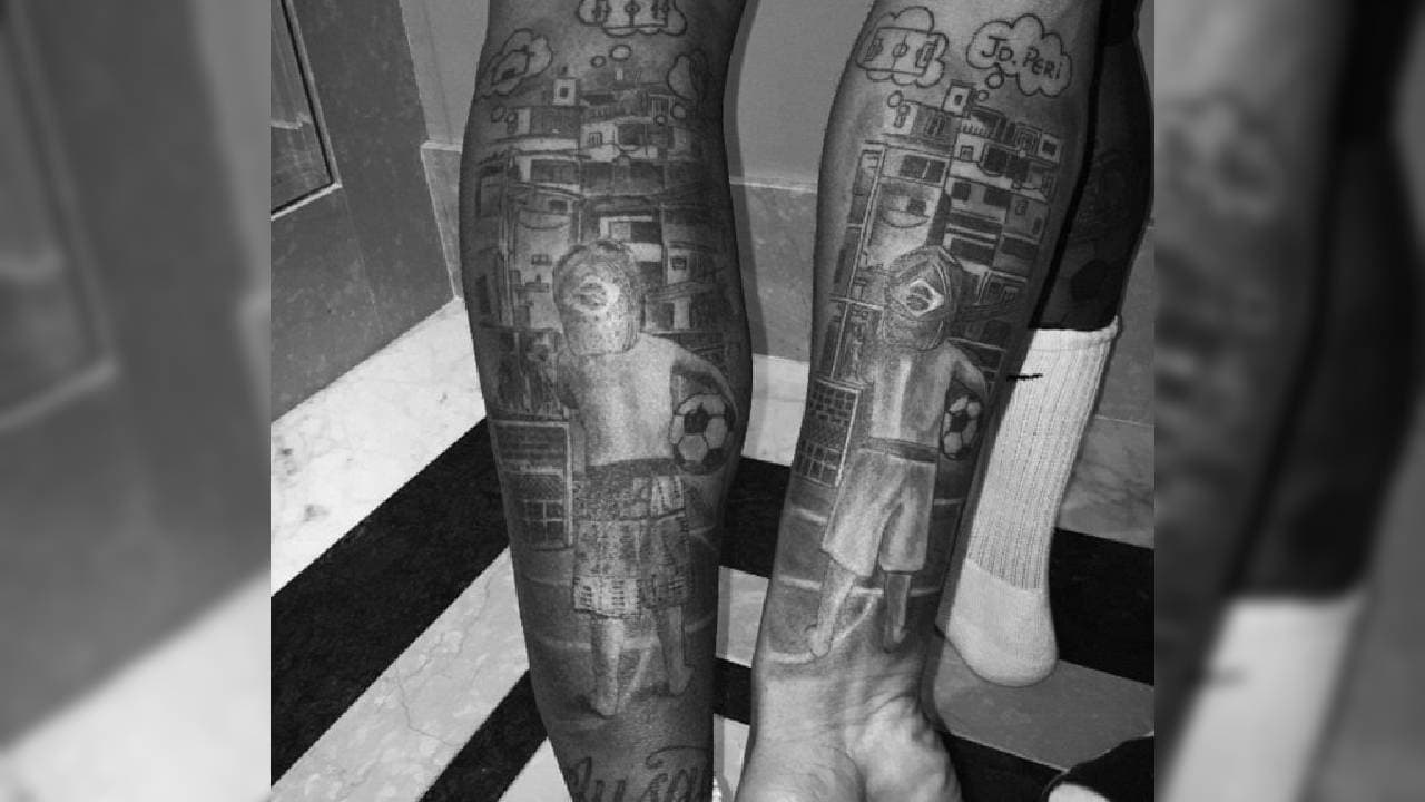 Impresionantes detalles sobre su pierna y brazo izquierdos.