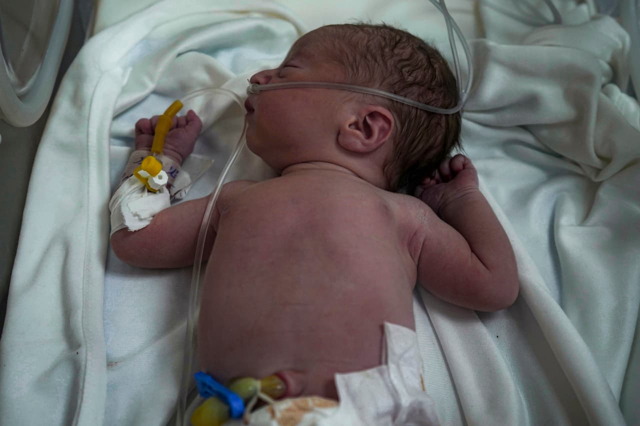 Este bebé nació de forma prematura después de que su madre, Ola al-Kurd, muriera en un ataque israelí. El bebé está en una incubadora en un hospital de Deir al-Balah. El niño una suerte de milagro en medio de lmiles de muerte en Gaza. El equipo médico logró sacar al bebé vivo de su madre palestina en avanzado estado de gestación.