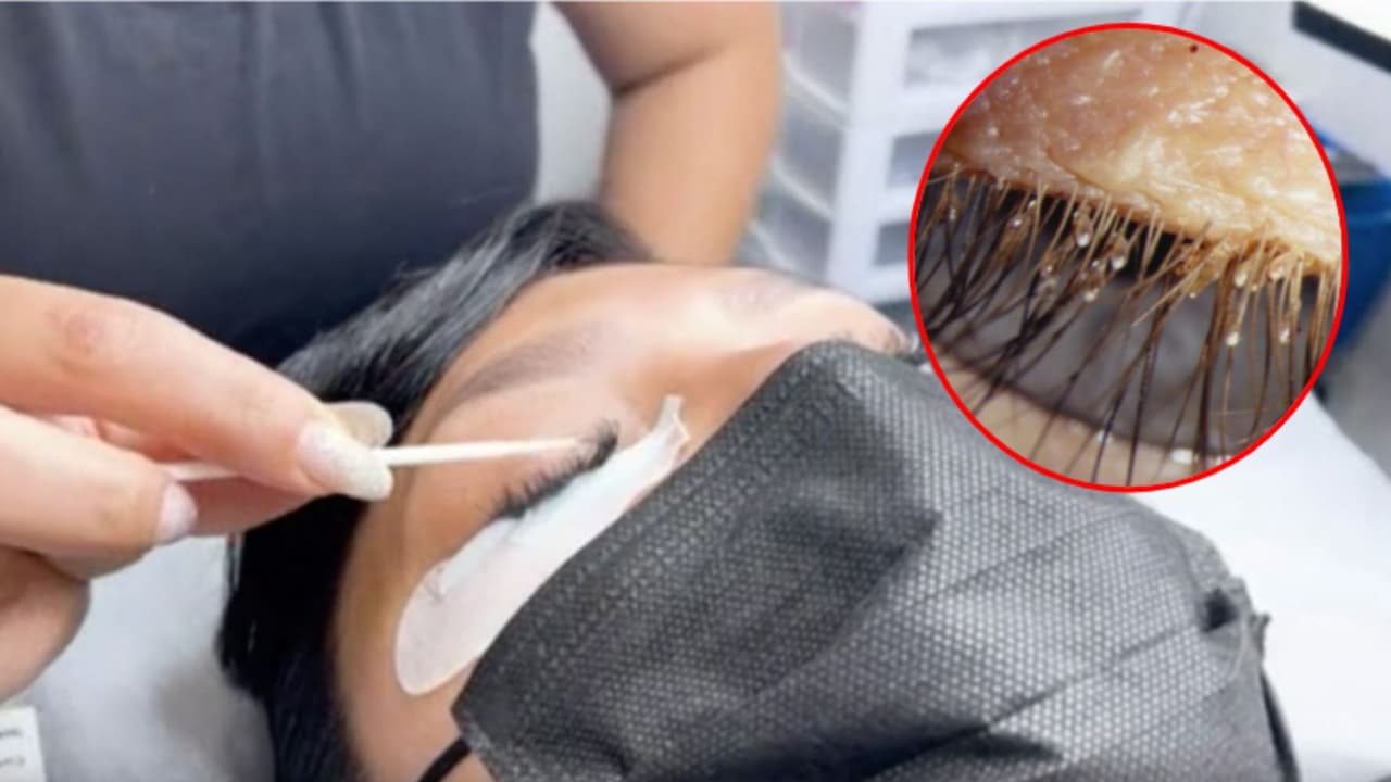 ¿Piojos en tus pestañas postizas? Esto debes hacer para evitar serias infecciones en tus ojos