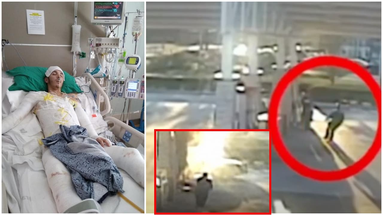 "Exigimos una investigación": abogados de joven que sufrió quemaduras en el 75% de su cuerpo durante arresto