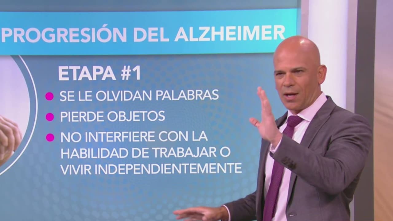 Cambios en tu estilo de vida para prevenir la pérdida de la memoria