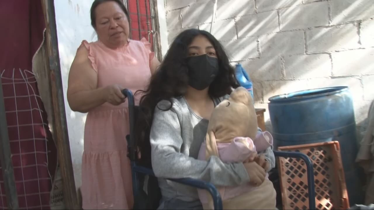 Estrellita, de 12 años, padece osteogénesis imperfecta y ya no puede caminar.