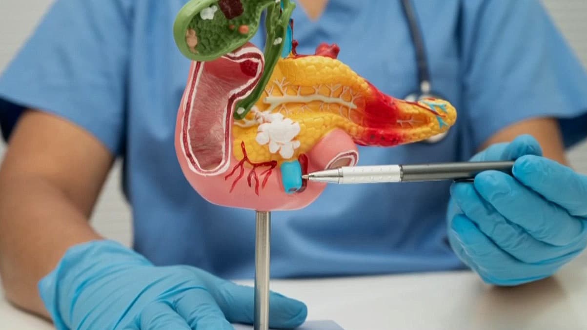 FDA aprueba una píldora que ‘duplica’ la supervivencia en cáncer de páncreas avanzado