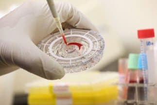 El “Avigan” un medicamento suministrado a la española Teresa Romero ampliará su producción en Japón. 