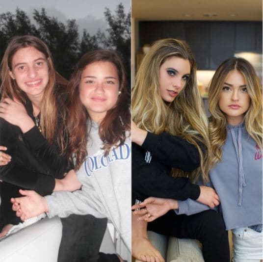 <b>Lele Pons</b> es otra de las 
<a href="https://www.univision.com/famosos/celebridades-tuvieron-una-sorprendente-transformacion-fisica-fotos">famosas que han cambiado mucho físicamente</a>.