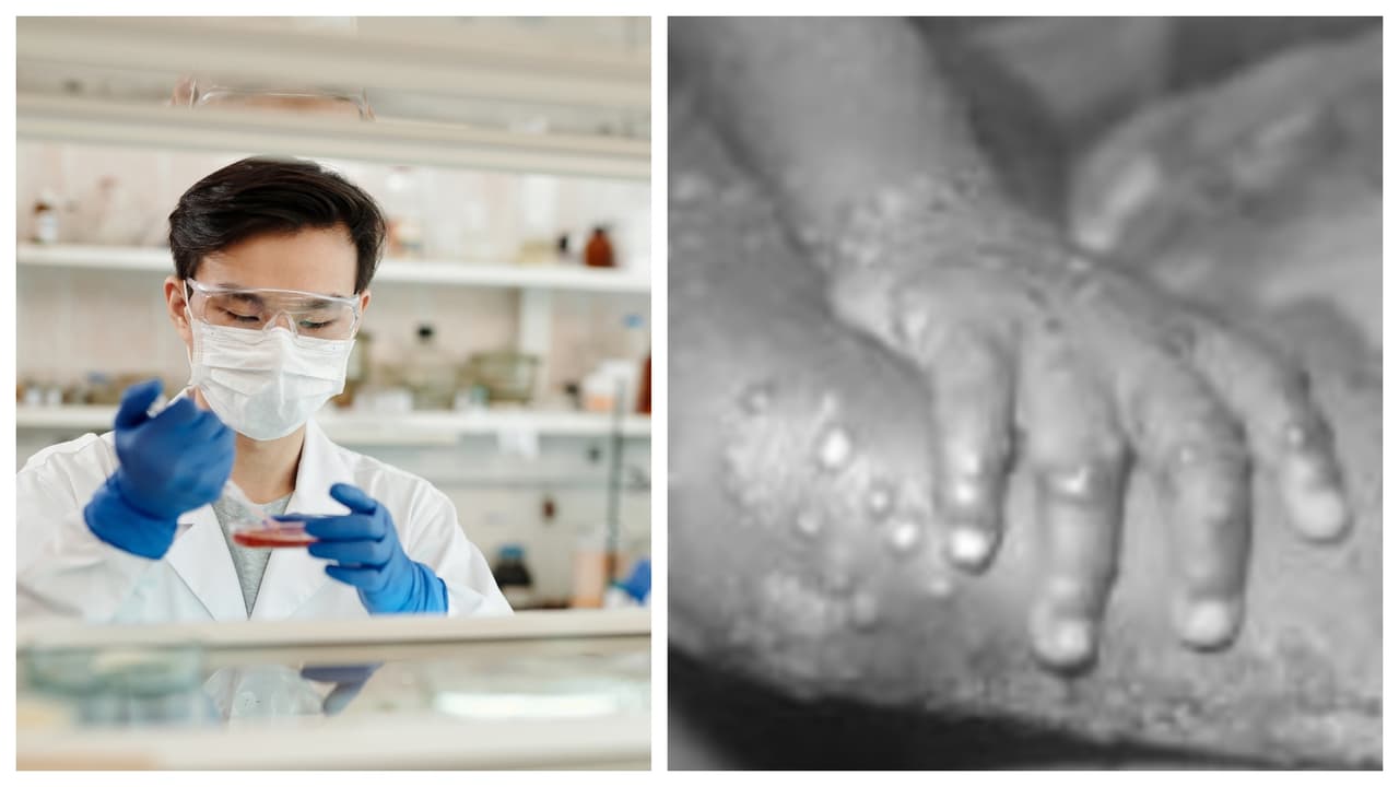 Así lo informó el alcalde de Broward Michael Udine, este martes por la tarde, cuando recibió la información del departamento de salud del condado.