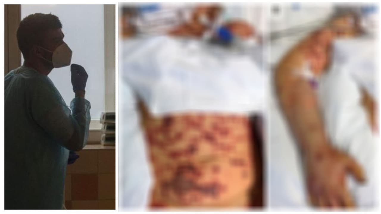  A joven de 19 años le amputan ambas piernas tras comer restos de una comida china