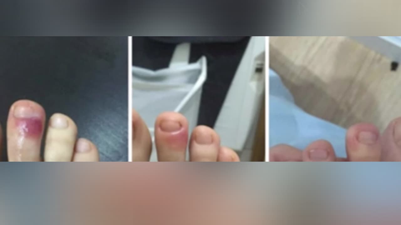 La recomendación es que, si los síntomas del coronavirus están presentes, acuda al médico de inmediato.