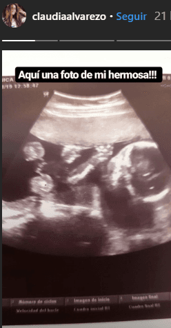 Con 19 semanas de embarazo, la actriz publicó la primera foto de su hija junto a la frase: ‘Aquí una foto de mi hermosa’. 
<br>