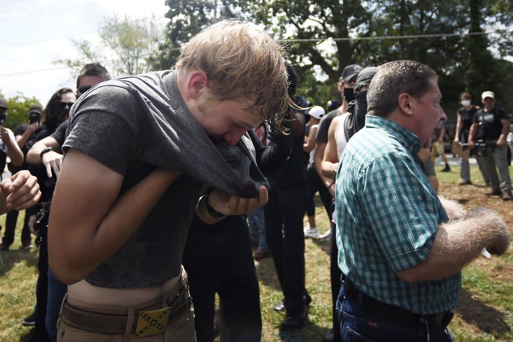 Más sobre esta controversial manifestación,
<b><a href="https://www.univision.com/local/atlanta-wuvg/famoso-parque-de-georgia-cierra-sus-puertas-a-grupos-de-extrema-derecha" target="_blank">aquí</a></b>.