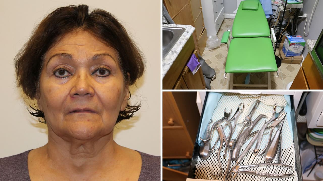 Mujer es acusada de montar un consultorio dental improvisado en la cocina de su apartamento en NY