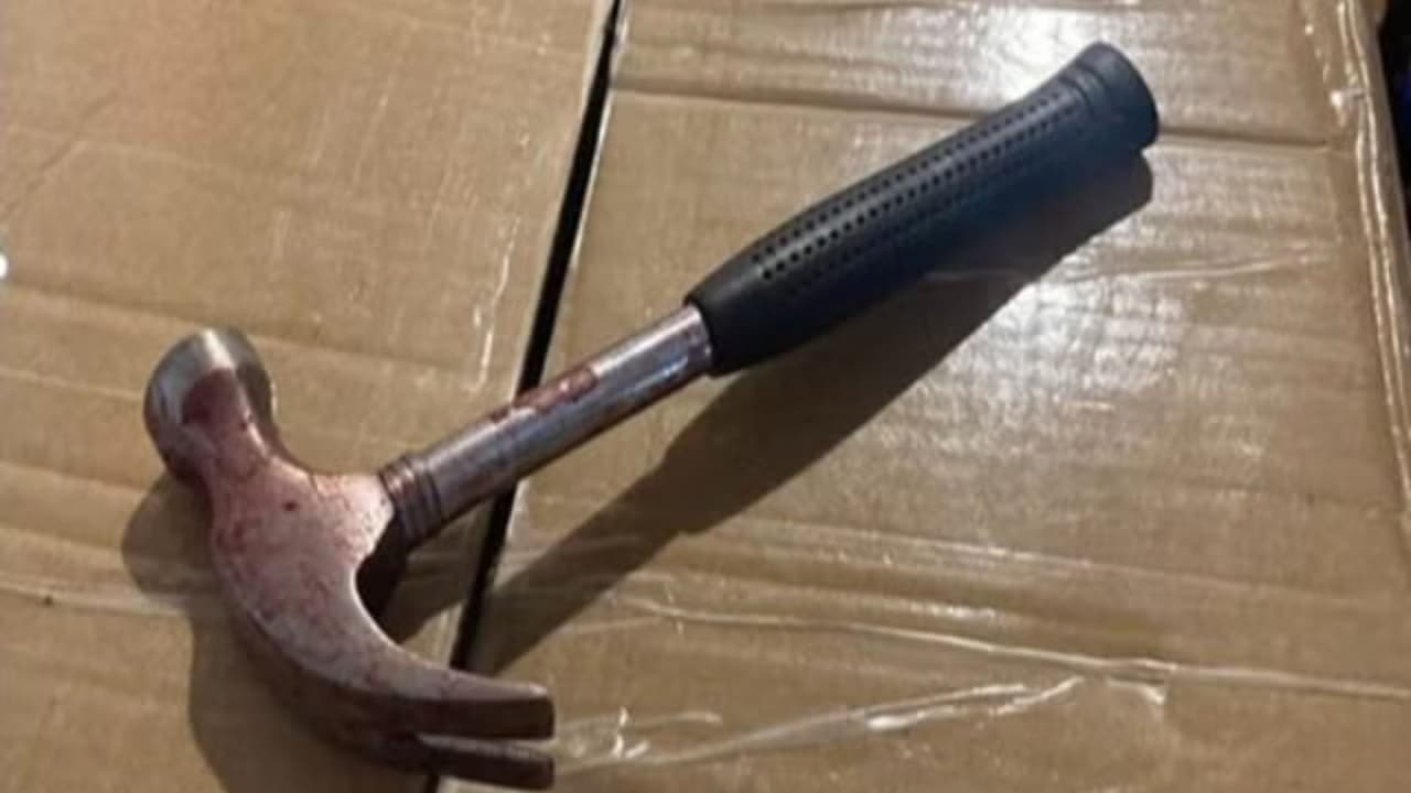 Niño afectado por ataque con martillo en Nueva York sufre amnesia temporal pero mejora su estado