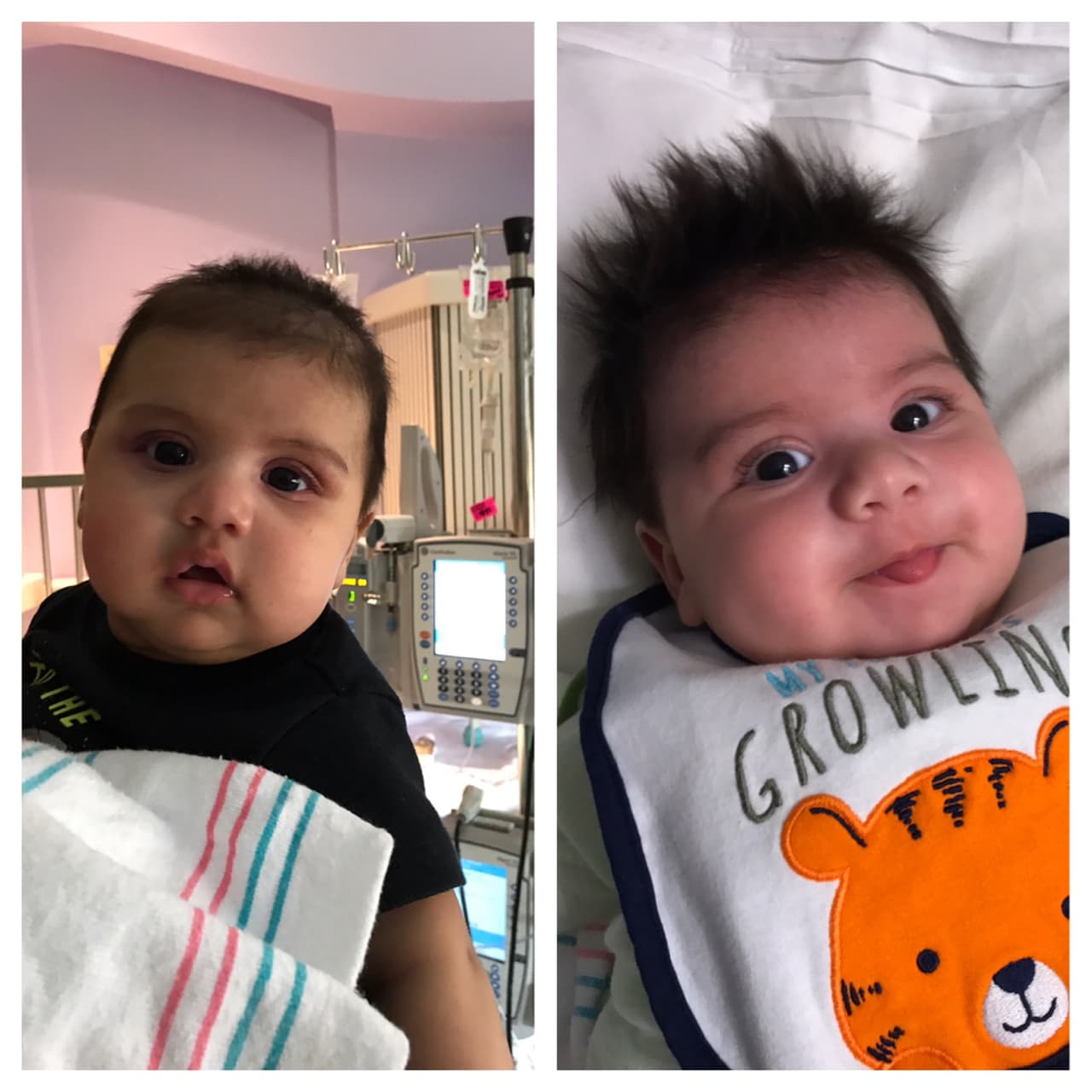 Sebastián después y antes de la quimioterapia.