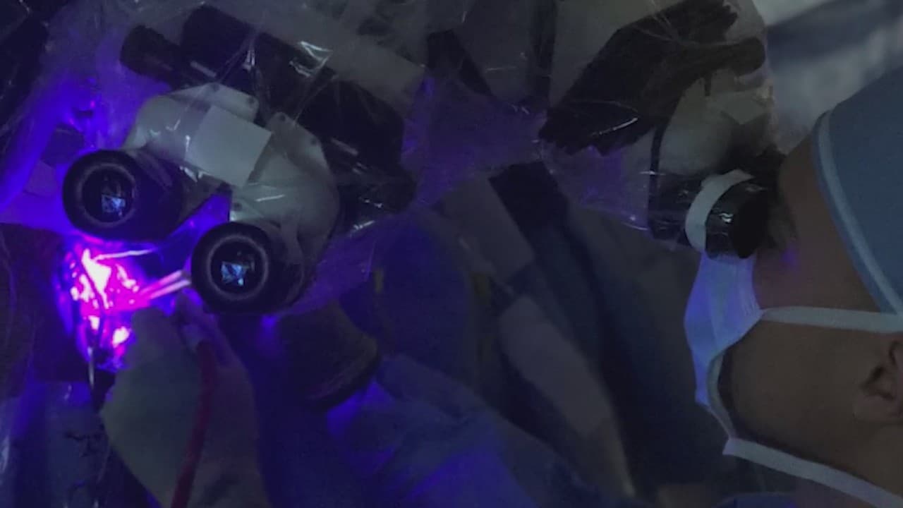 Nueva tecnología detecta células de cáncer en el cerebro y hace más fácil las operaciones