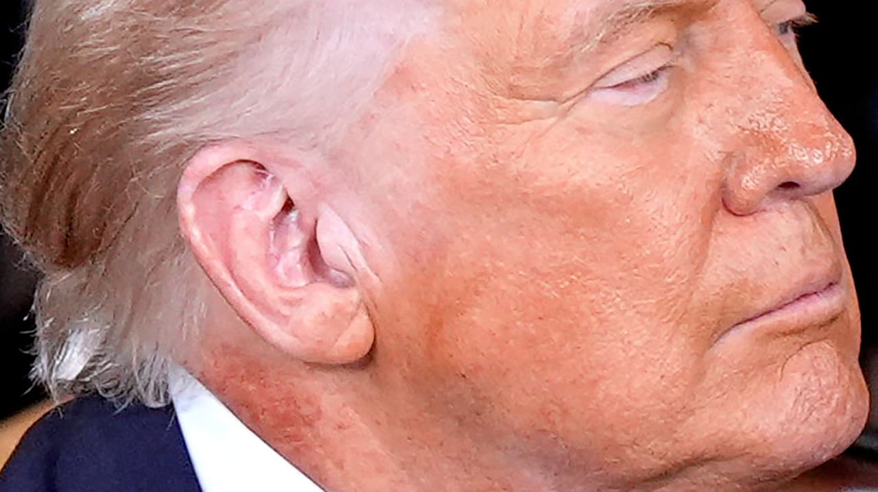 Mancha roja en el cuello de Donald Trump se vuelve viral, ¿qué le pasó al presidente?