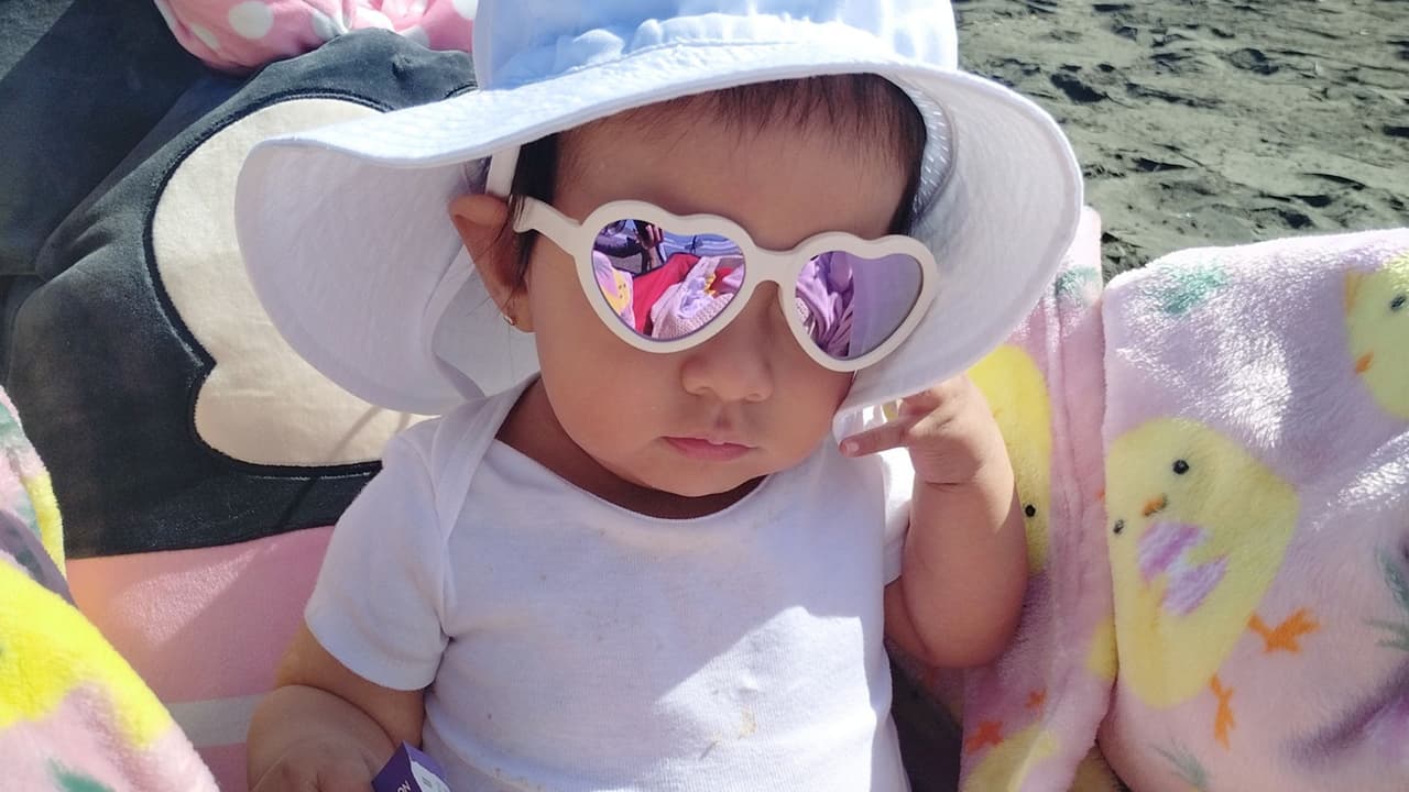 Una bebé peruana sin sistema inmunológico recibe terapia genética en San Francisco y muestra signos de recuperación, brindando esperanza a otros niños con la misma condición genética.