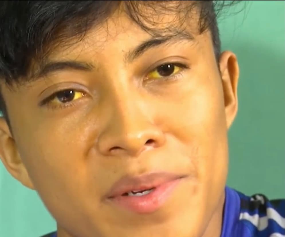 <b>“La única solución es el trasplante”,</b> dice un afligido Numan, quien ve cómo la vida de 90 días que le quedan a sus últimas luces se va diluyendo poco a poco. 
<br>