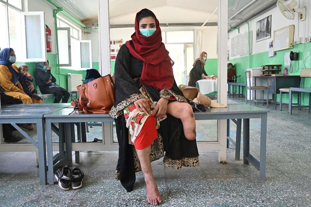 Estados Unidos, que no adhirió al convenio de la ONU, no lo ha hecho porque diferencia las minas terrestres “inteligentes”, que se desactivan automáticamente, de las “tontas”, que duran indefinidamente. EEUU no descarta el uso de las primeras. 
<br>
<br>Aún falta mucho por hacer, 
<b>ya que decenas de muertes ocurren todos los días en campos minados del mundo. Las organizaciones que luchan contra estos explosivos esperan que todos los países (aún faltan al menos 32)</b> se unan al tratado además de la limpieza total de minas para 2025.
<br>
<br>En la foto, una víctima de las minas en un centro de rehabilitación en Kabul el 28 de junio de 2021.