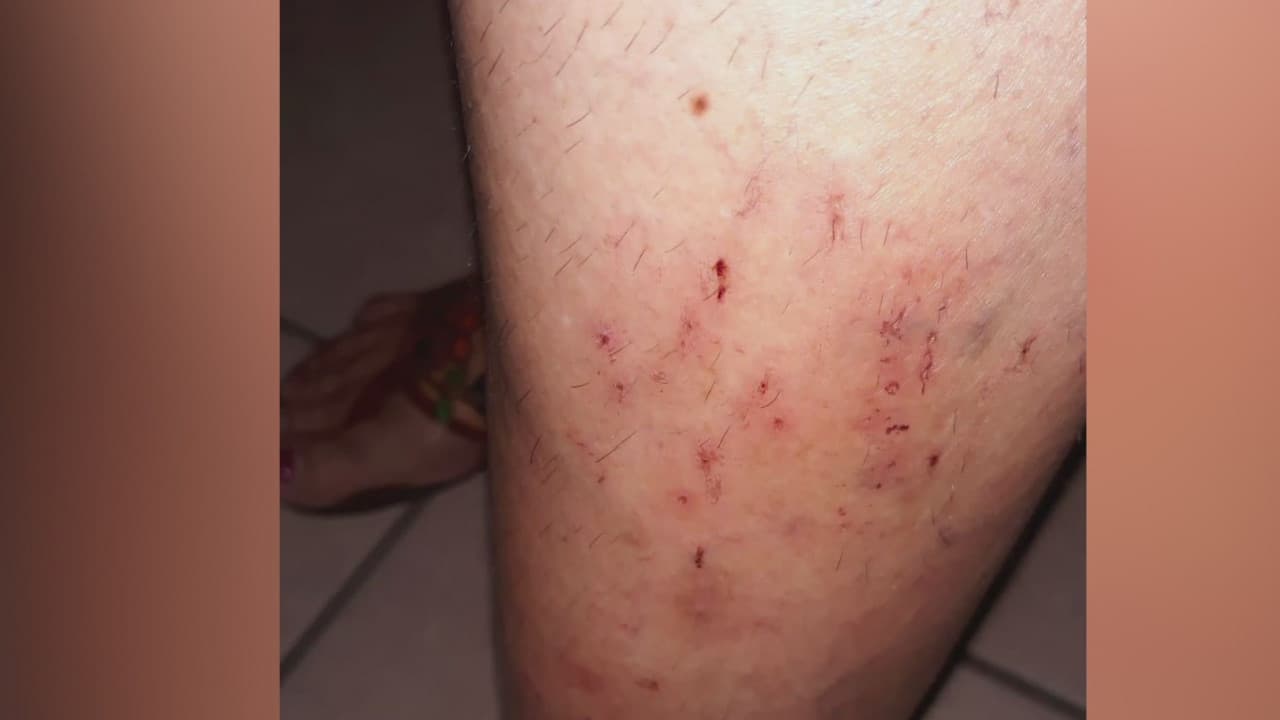 Abuelita está durmiendo en la cocina debido a una infestación de ácaros en su apartamento