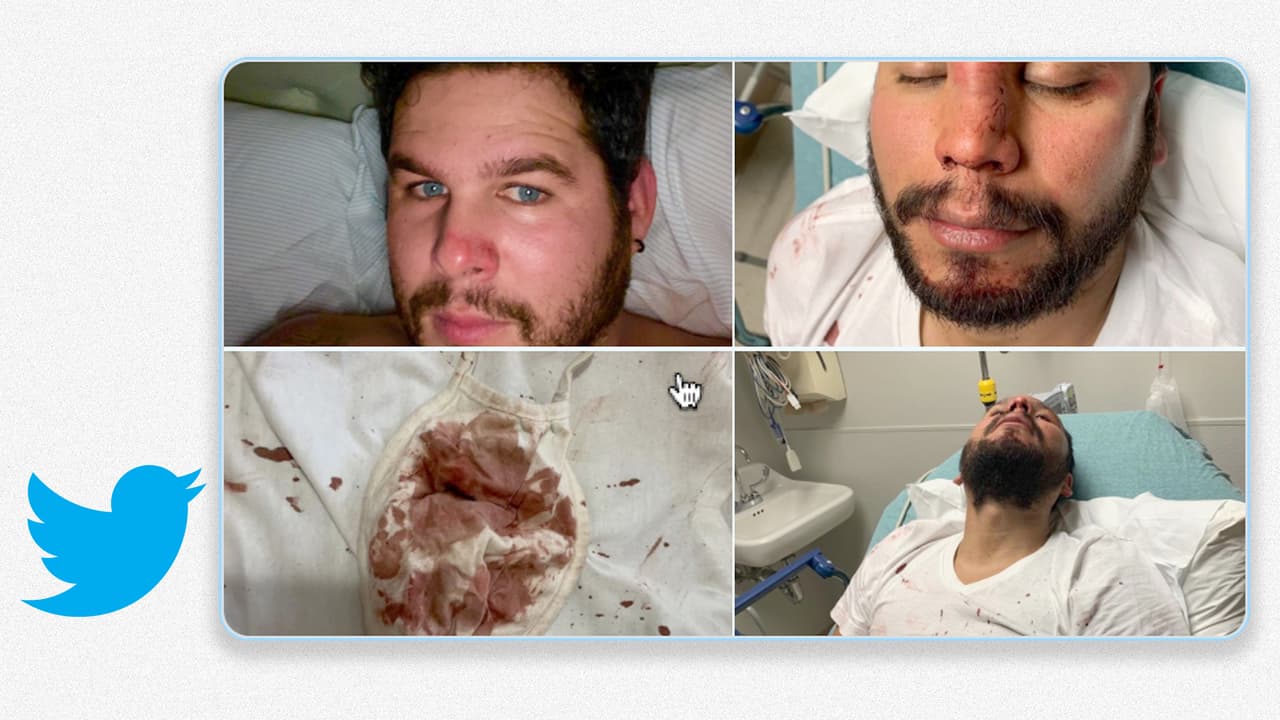 "Brutal golpiza" por hablar español: la denuncia de unos músicos latinos que acabaron en urgencias