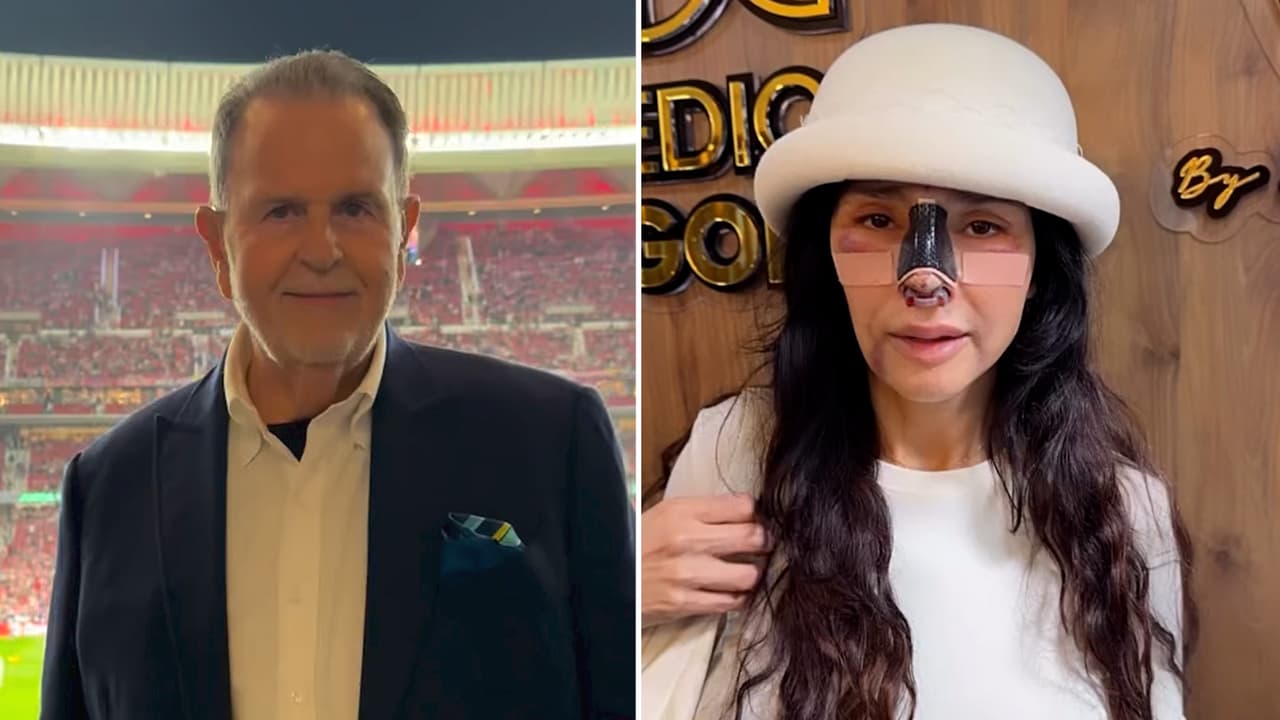 Raúl de Molina reacciona a desgracia que vive excolaboradora de El Gordo y La Flaca tras cirugía