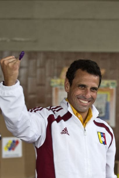 Afirmó que "los atropellos tienen que ser puestos en evidencia para que el mundo conozca y eso obligue a los que se tapan los oídos o no quieran ver a que tengan que actuar", indicó al ser preguntado por supuestas denuncias de abuso de medios por parte del Gobierno. (Con información de Efe)