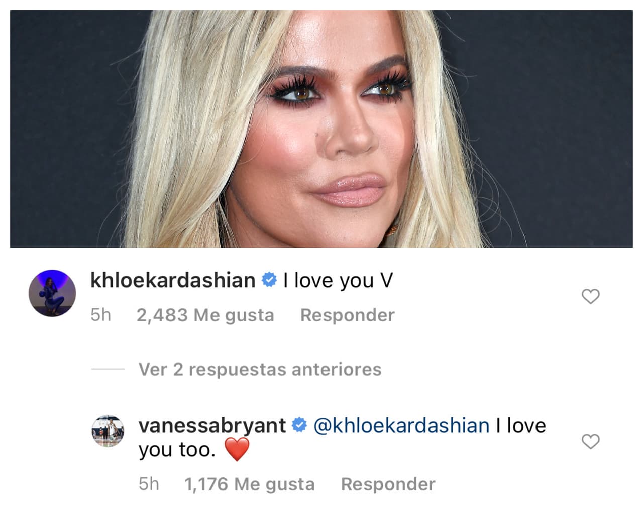 Mientras tanto, Vanessa Bryant no solo fue arropada por el cariño de J-Lo, sino también por otras celebridades como
<b>Khloé Kardashian. </b>
<br>