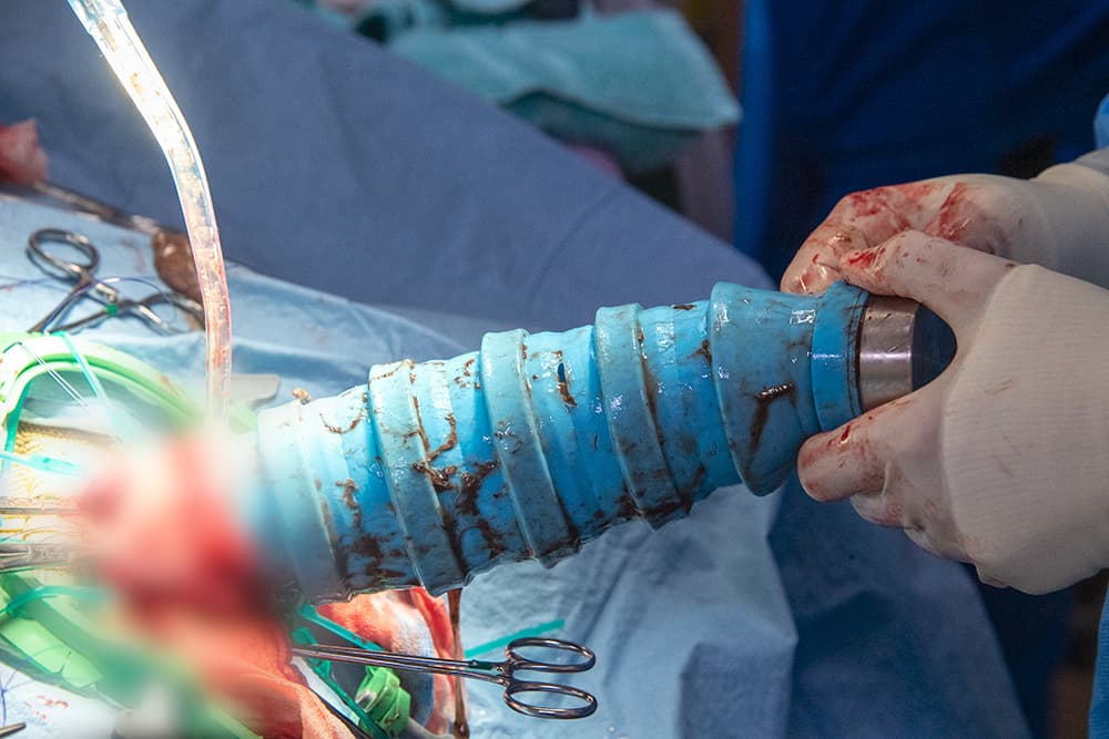 Si el objeto que se tragó “Estrella”, como se llama este lagarto, no hubiese sido removido de su estómago, habría muerto, pues no lo podía desechar por sí misma. 
<br>