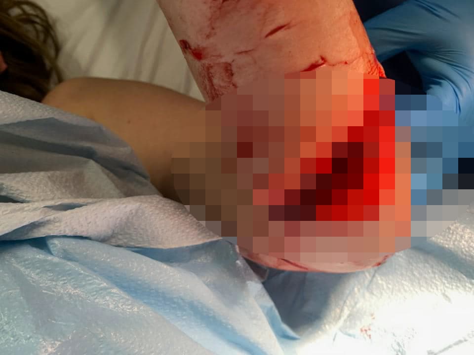 Una joven de Cabo Rojo sufrió un ataque de un pez desconocido en la playa Combate.
<br>