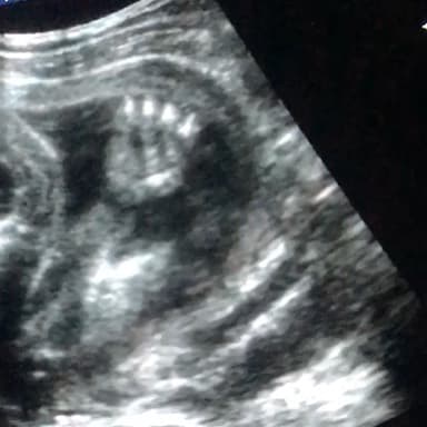 Conocemos al pequeño desde que estaba en el vientre de su madre, y esta fue la primera imagen que compartió 
<b><a href="http://www.univision.com/temas/anahi">Anahí,</a></b> cuando anunció su embarazo.