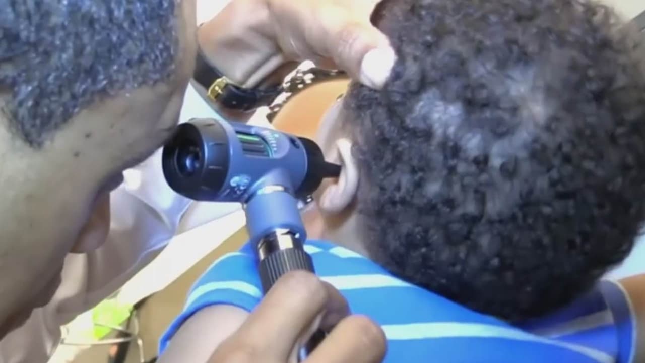 FDA aprueba terapia génica para curar la sordera en niños ¿De qué se trata?