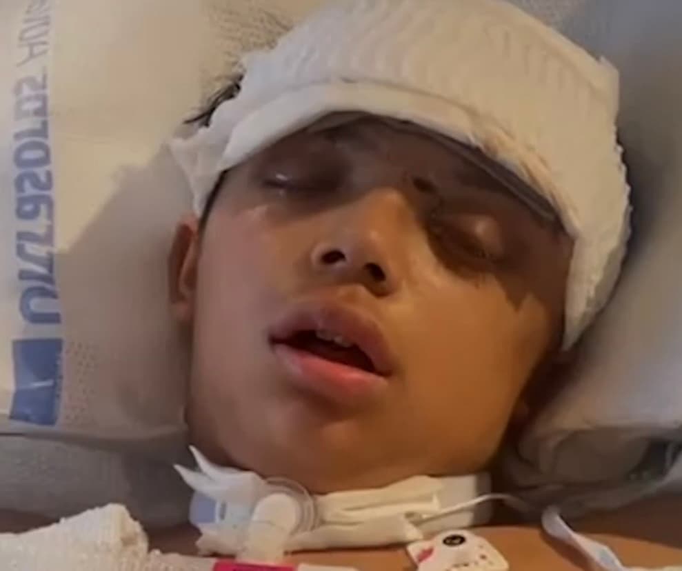 Sacado de sí y furibundo, el conductor de la camioneta no se detuvo a razonar lo que estaba a punto de hacer, por lo que, sin perder tiempo y dejar de conducir, comenzó a balear el vehículo en el que Gabriel ocupaba el asiento del copiloto, recibiendo el impacto de 5 balas; una de ellas en su cabeza.
<br>
<br>