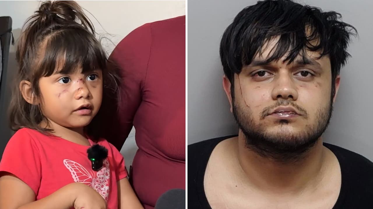 Hombre muerde en el rostro a una niña de 3 años que paseaba en un parque de San Antonio