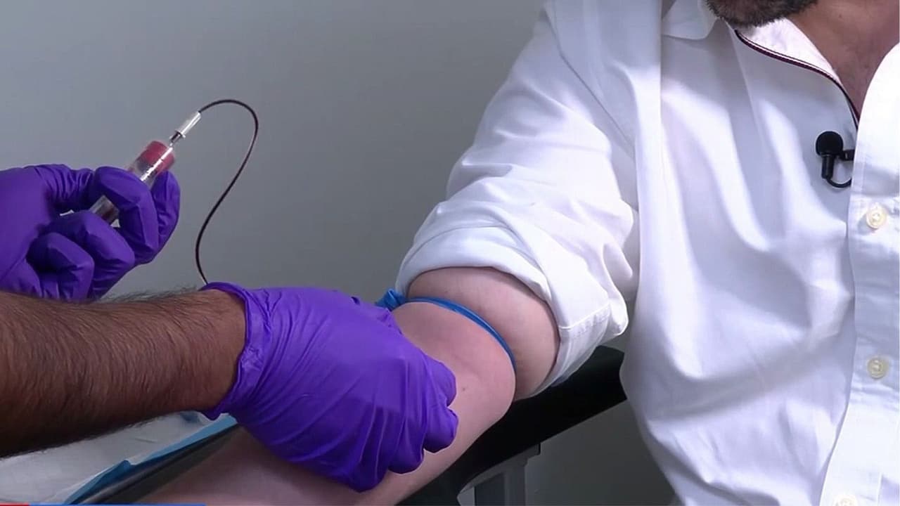 Primer transplante de órganos entre personas con VIH se realiza en Los Ángeles: ¿Cuál es la importancia de este avance médico?