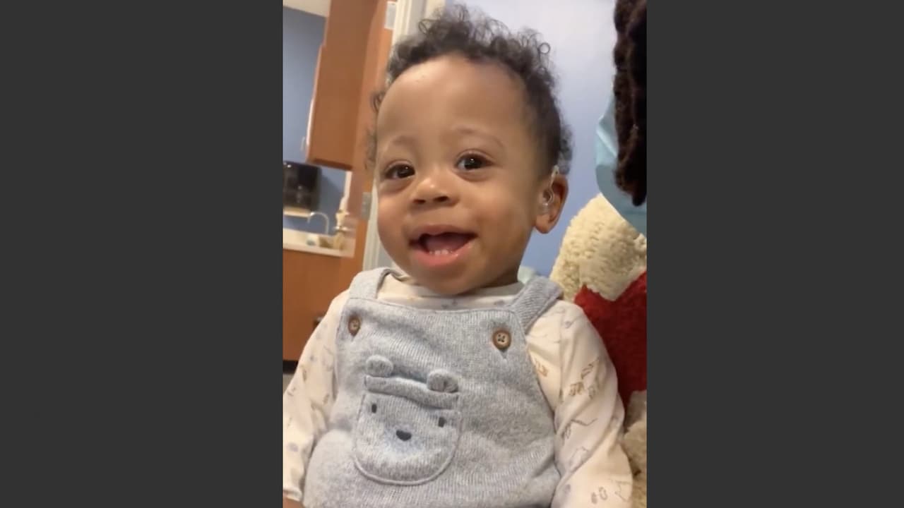 <b>Así fue el momento en que este bebé con problemas auditivos escuchó la voz de su mamá por primera vez. | </b>Este pequeño logró sobrevivir pese a que nació a los cuatro meses de gestación. Los doctores le detectaron deficiencias auditivas y no fue hasta 18 meses después de su nacimiento que escuchó por primera vez la voz de su madre.